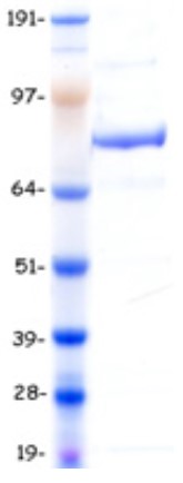 SDS-PAGE (MLH1-2320H).jpg